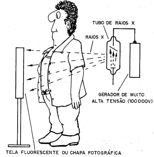   Figura 10 – A radiografia
