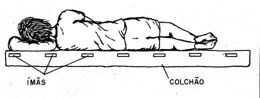  Figura 1 – Uma aplicação da magnetoterapia
