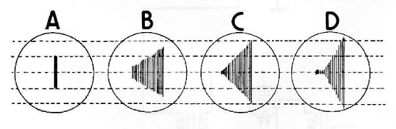 Figura 3 - Onda portadora analisada em osciloscópio; A -sem modulação; B -com 80 por cento de modulação; C -com 100 por cento de modulação; D -com excesso de modulação.
